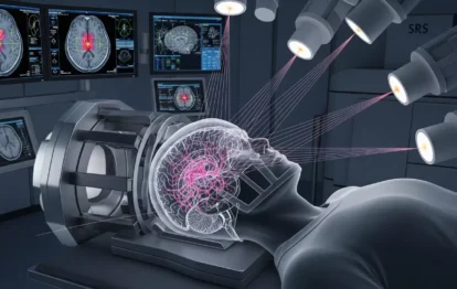 Radiocirurgia Malformação Arteriovenosa (MAV)